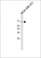 Anti-Estrogen Receptor alpha antibody
